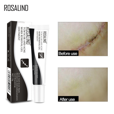ROSALIND Scar Removal Cream for Scar Removal Surgery